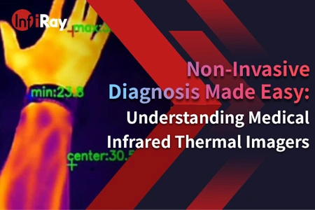 Nicht invasive Diagnose leicht gemacht: Verständnis von medizinischen Infrarot-Wärme bild geräten